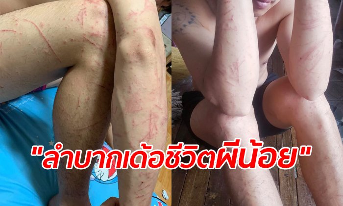 เปิดเบื้องลึกชีวิต "ผีน้อยเกาหลี" สาวโพสต์ภาพสงสารผัว หนี ตม. ขึ้นเขาซ่อนในกอไผ่