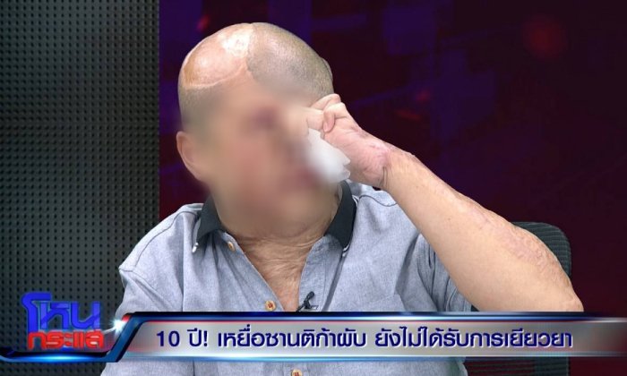 10 ปีแห่งความทรมาน เปิดใจเหยื่อ "ซานติก้าผับ" คดีสิ้นสุดแล้ว แต่ไม่ได้รับเงินเยียวยาสักบาท