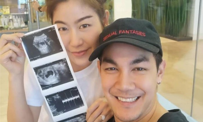 "กิก ดนัย" สุดเห่อ รู้เพศลูกคนแรก เตรียมชื่อไว้แล้ว มีความหมายลึกซึ้ง