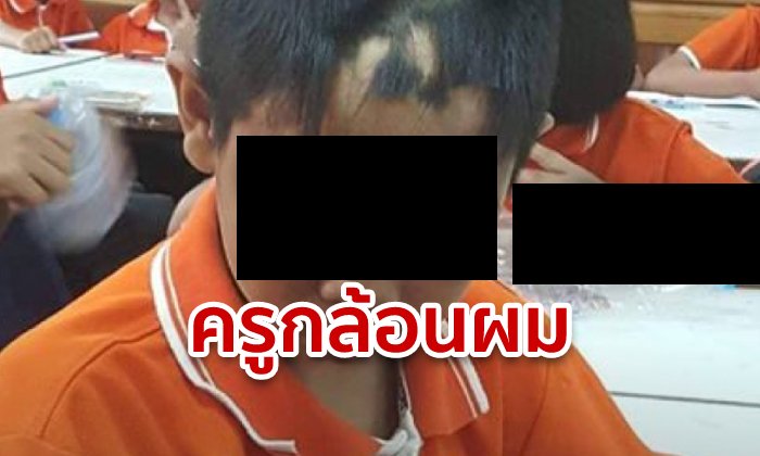ครูขอนแก่น กล้อนผมหน้านักเรียน ไม่แคร์แผลไฟไหม้บนหน้า แถมยัดเงิน 120 ห้ามฟ้องพ่อแม่