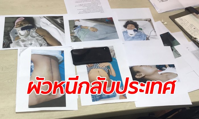 สาวตายทั้งเป็น สามีฝรั่งพุ่งชนจนตกตึก 5 ชั้น กระดูกสันหลังหัก-ไส้แตก กลายเป็นคนพิการ