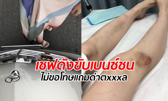 สาวโพสต์แฉ "เชฟหญิงชื่อดัง" ขับเบนซ์ชนไม่ยอมขอโทษ ด่าหยาบ-โกหกว่าเป็นหมอ