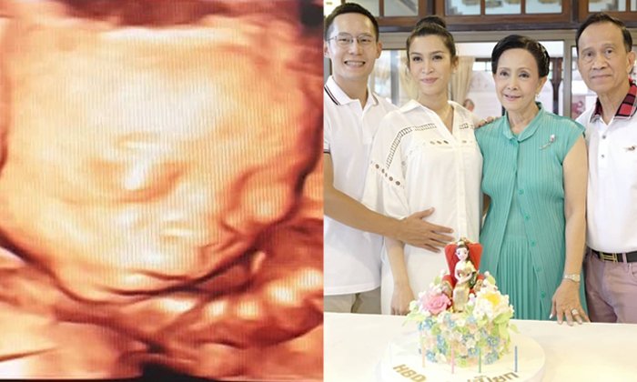 ลูก "อีฟ พุทธธิดา" หน้าตาดีตั้งแต่ในท้อง ถอดแบบ "คุณตาเศรษฐา" เป๊ะๆ