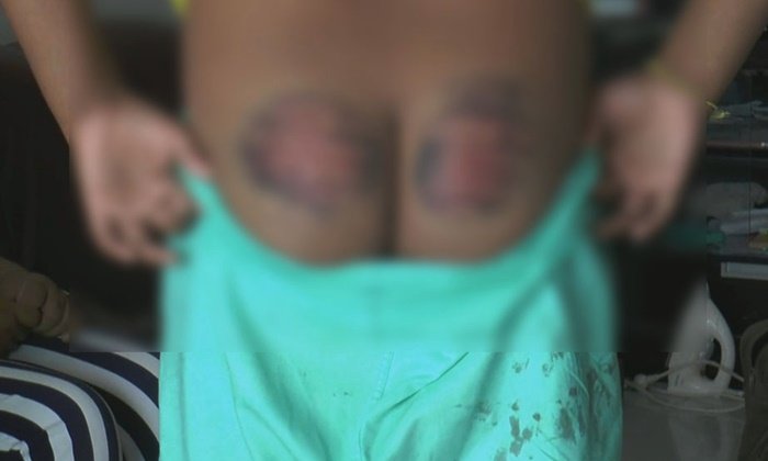 สั่งสอบคุณครูโหด ป.6 ท่องสูตรคูณไม่ได้ ใช้ไม้เรียวตีก้นลูกศิษย์ช้ำ
