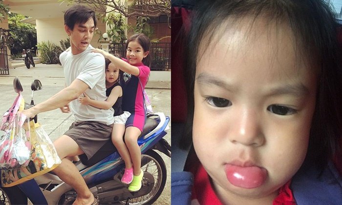 "มอส ปฏิภาณ" โพสต์ภาพลูกสาวคนเล็ก "น้องสวรรค์" ปากบวมจนน่าตกใจ