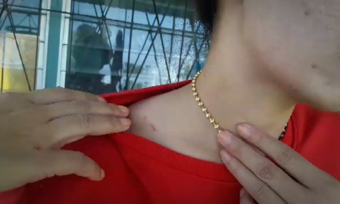 ตัดบทจบดราม่า ผอ.โรงเรียนหึงโหดเคลียร์กิ๊กสาว ยุติปมฉาวบุกบ้านทำร้าย