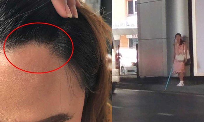 สาวออฟฟิศ งง! เดินอยู่ดีๆ โดนหญิงแปลกหน้าใช้ท่อพีวีซีฟาดกลางหัว
