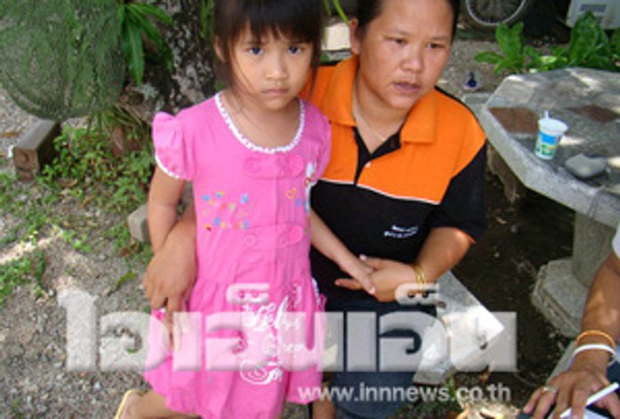 แม่เด็กป.2 โวย ครูตีลูกขาบวม-เคยโดนถีบ
