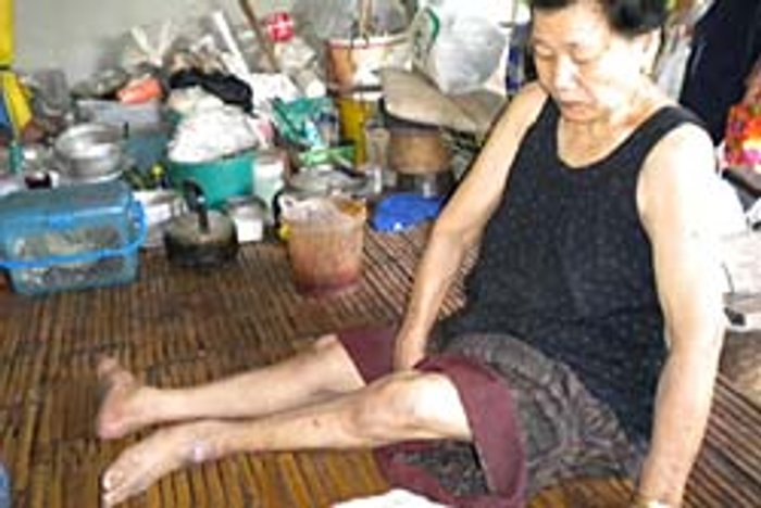 สลด! ยายขาลีบ วัย 68 ทำงานนวดเลี้ยงชีวิต