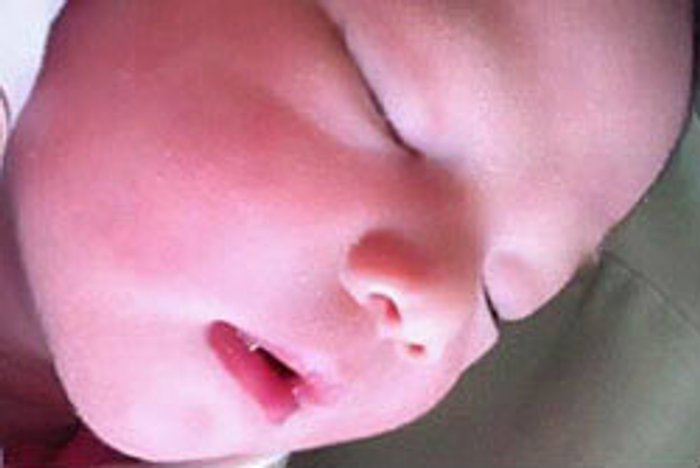 "มอส ปฏิภาณ"เฮ"เกม ดวงพร"คลอดลูกสาว"น้องโสน"