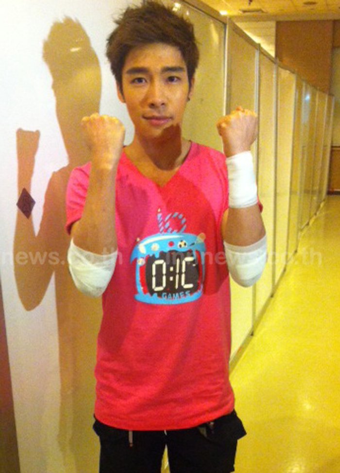 ณัฐ ศักดาทรแข่งกีฬาสีล้มศอกแตกรับกระทบงาน