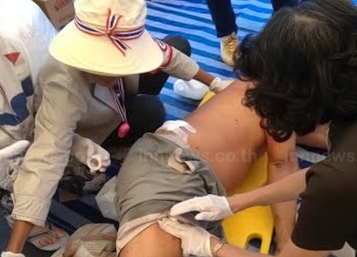 ศูนย์เอราวัณสรุปเจ็บบึ้มอนุสาวรีย์ชัยฯในร.พ.