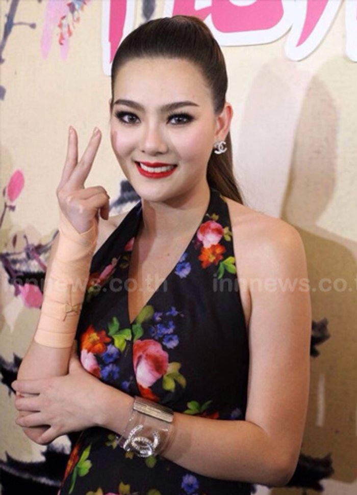 ดิว ลื่นล้มกระดูกร้าวหมอสั่งพัก รับกระทบงาน