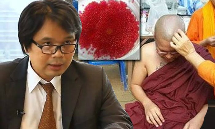 อาจารย์ ม.เกษตร โชว์ผลตรวจเลือดไหลเป็นพระธาตุ