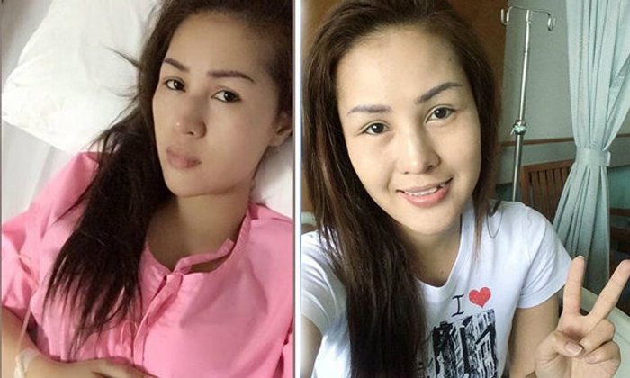 อัพเดทอาการหญิงลี หลังปวดหัวหนักมาก ต้องแอดมิดด่วน
