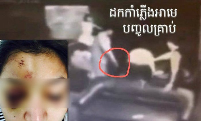 นักธุรกิจเขมร ทำร้าย ดาราสาวอ่วม เป็นข่าวฉาว