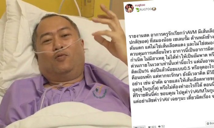 อัพเดทอาการ ครูรัก ศรัทธา ศรัทธาทิพย์ เส้นเลือดขอดในสมองน้อยแตก