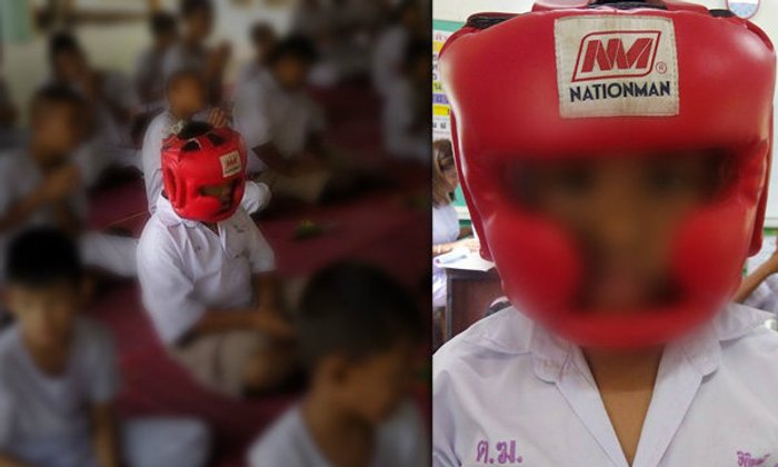 ชาวเน็ตแชร์ เด็ก ป.2 ใส่เฮดการ์ดไปเรียน เหตุป่วยลมชักรุนแรง