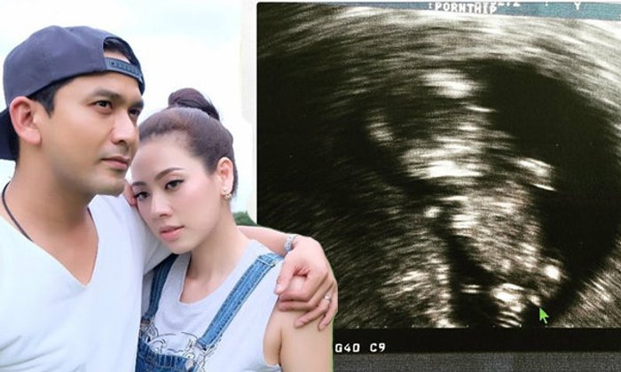 ป๋อ อวดภาพอัลตร้าซาวด์ลูกคนที่สอง บอกให้สังเกตที่ลูกศร