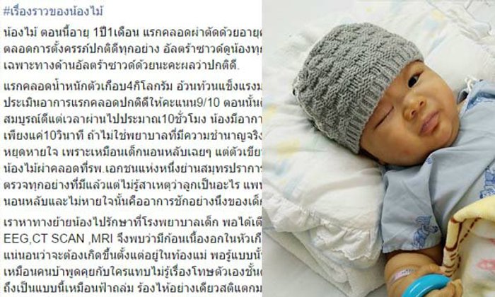 ชาวเน็ตแชร์กำลังใจถึง น้องไม้ หนูน้อย 1 ขวบ สู้กับมะเร็งสมอง