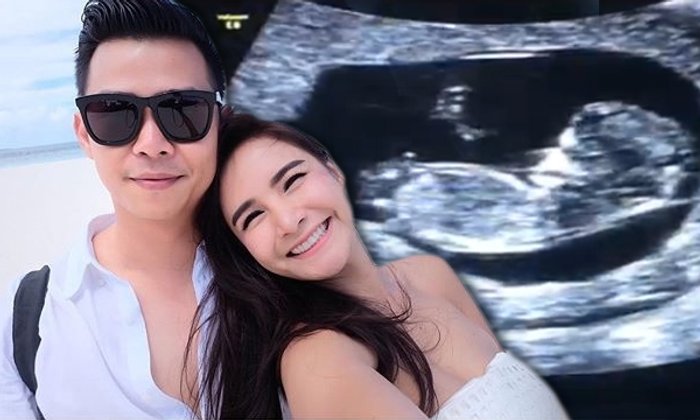 ท้องแล้วจ้า! กระแต ศุภักษร โชว์ภาพอัลตราซาวด์ลูก 12 สัปดาห์