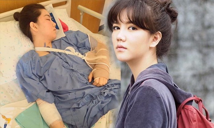 ฟาดเคราะห์รับปีใหม่ "ริชชี่ อรเณศ" ขี่จักรยานตกเขา