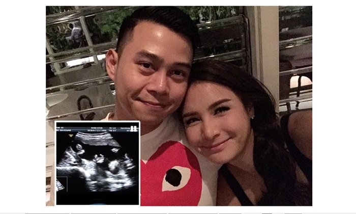 กระแต ศุภักษร อวดภาพอัลตร้าซาวด์ ลูกสาว 7 เดือน
