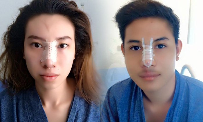 สอบแพทย์-คลินิก เสริมดั้งฟรี แจ๊ค-เบญ คู่กรณีแพท ณปภา