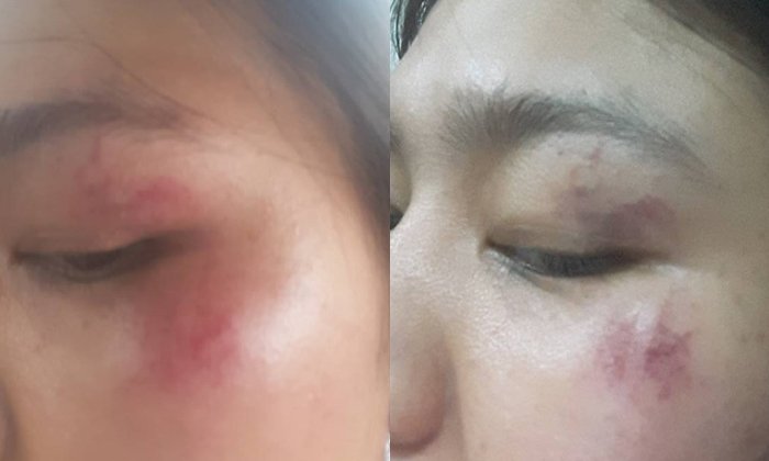 แชร์สนั่น! สาวถูกนายจ้างกระทืบหน้า เหตุแค่ขอลาออก