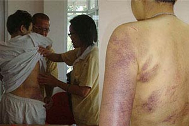 สาวเลขาฯร้องปวีณาถูกหมอลูกอดีตส.ส.ขังทุบตี