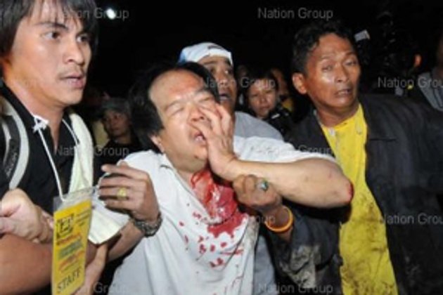 ปทีป เต้นพบเอ็ม79บึ้มข้างหลังเวทีพันธมิตร