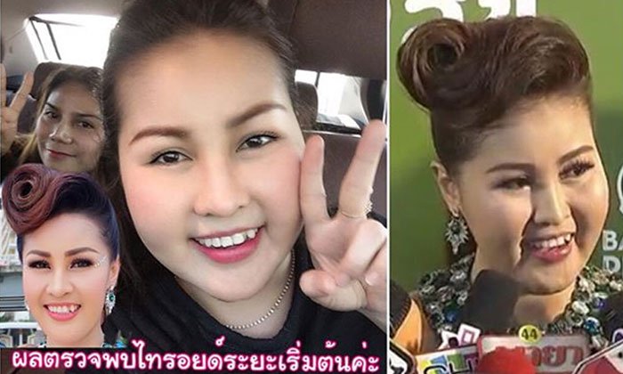 หญิงลี ออกมาอัพเดทสาเหตุอาการหน้าบวม