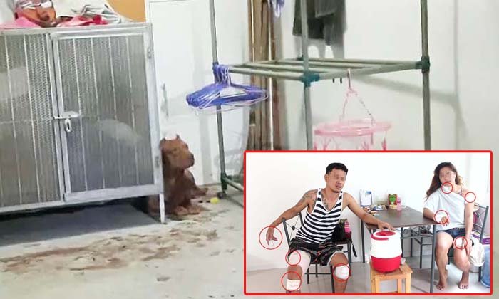 ขยาด! คู่รักเลี้ยงพิทบูล แต่ถูกกัดบาดเจ็บทั้งคู่