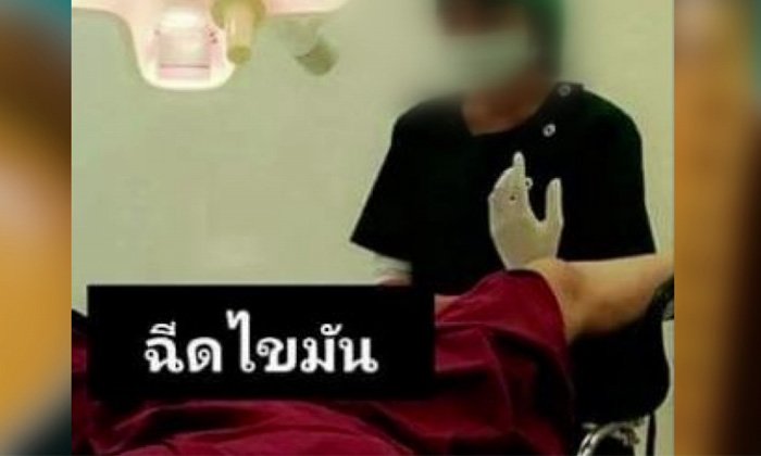 ศัลยแพทย์เตือนฉีดไขมัน “จิ๊มิ 3 มิติ” เพื่อให้นูนสวย มีความเสี่ยง!