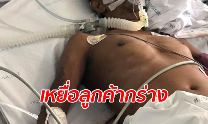 พนักงานรีสอร์ทถูกลูกค้ากระทืบ 3 รุม 1 เพราะไม่รู้จัก ปวดหัวรุนแรง เสียชีวิตแล้ว