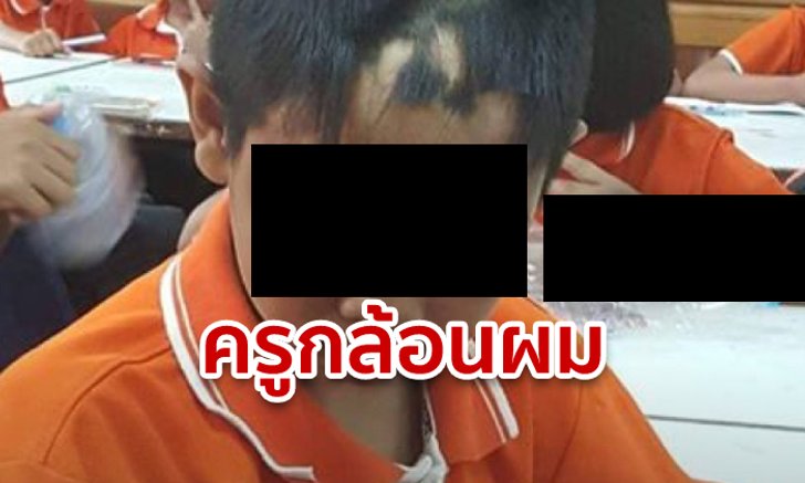 ครูขอนแก่น กล้อนผมหน้านักเรียน ไม่แคร์แผลไฟไหม้บนหน้า แถมยัดเงิน 120 ห้ามฟ้องพ่อแม่