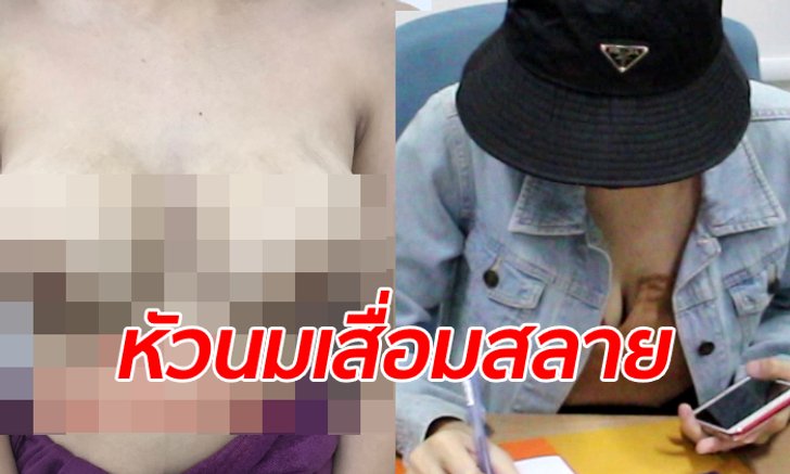 สาวทุกข์ระทม คลินิกศัลยกรรมทำหัวนมเน่าทั้ง 2 ข้าง เครียดจนคิดฆ่าตัวตาย