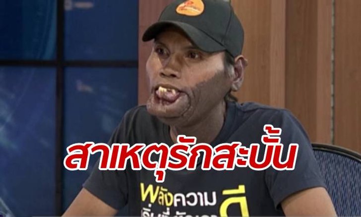 "พี่มีมี่ หนุ่มหน้าปาน" รับพลั้งมือหนเดียว ทำร้ายแฟน หวังเป็นเพื่อนที่ดีต่อกัน