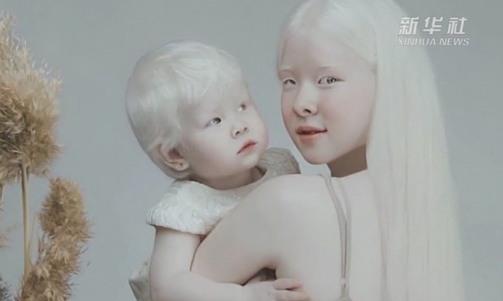 พี่น้องคาซัคสถาน "ผิวเผือก" ดังเปรี้ยงเป็นเน็ตไอดอล แตกต่างแต่งดงาม