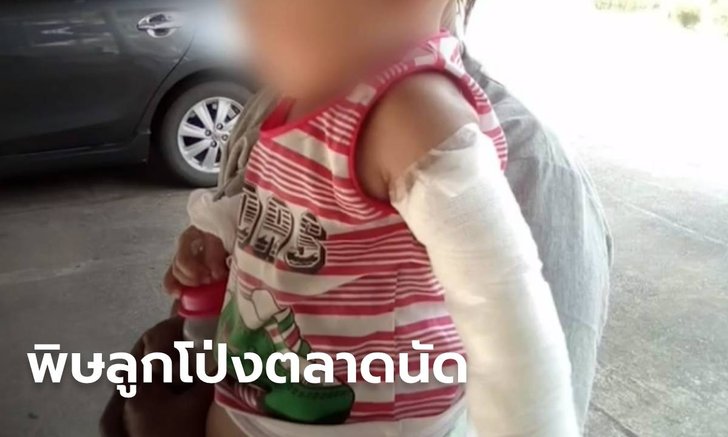 ภัยลูกโป่งอัดแก๊ส ระเบิดบึ้มใส่เด็กน้อย เหตุใช้สารราคาถูก-ติดไฟง่าย