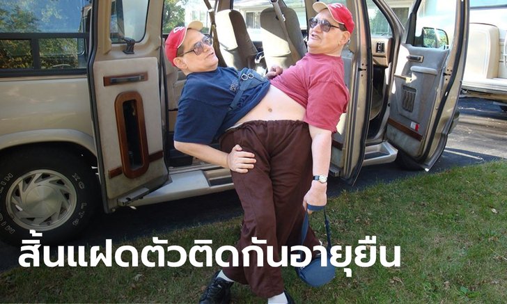ฝาแฝดตัวติดกันอายุมากที่สุดในโลก เสียชีวิตแล้วด้วยวัย 68 ปี