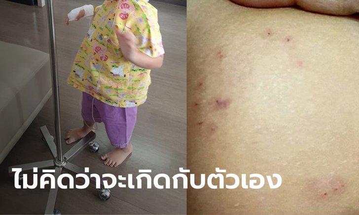 คอนโดกลางกรุงยังไม่รอด แม่ช็อกงูพุ่งจากชักโครกกัดก้นลูกวัย 4 ขวบ