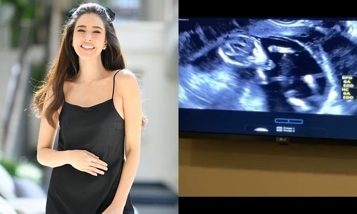 "ศรีริต้า" สุดตื่นเต้น เผยคลิปอัลตร้าซาวด์ลูกในท้อง 13 สัปดาห์