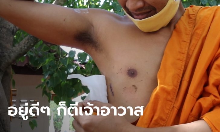 พระลูกวัดโหด ดักเอาเหล็กฟาดเจ้าอาวาสเลือดสาด โมโหถูกตำหนิเรื่องเล่นเฟซบุ๊ก