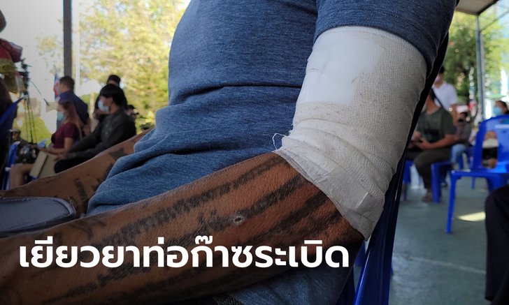 เหยื่อท่อก๊าซระเบิด รับมอบเงินเยียวยาจาก ปตท. จ่ายเบื้องต้นแล้ว 26 ล้านบาท