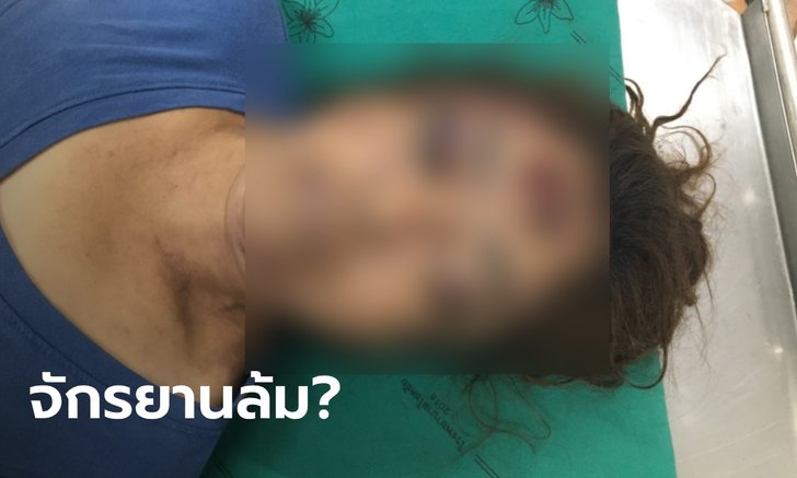 สาวใหญ่โคราช ตายปริศนาในบ้าน รอยช้ำทั่วร่าง แฟนใหม่อ้างขี่จักรยานล้มเอง