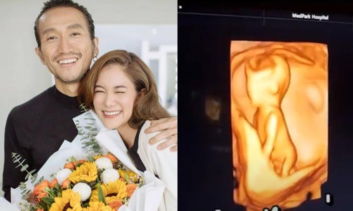 "ก้อย-ตูน" เฉลย 1+1 = 3 ท้องลูกคนแรกแล้ว แฟนๆ แห่ยินดีล้นหลาม