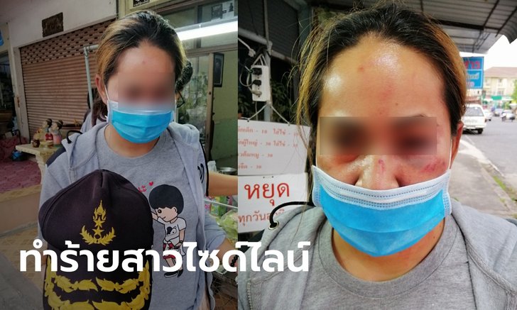 หนุ่มโหดบีบคอ-ทำร้ายสาวไซด์ไลน์ เหยื่อกัดนิ้วสู้ จนคนร้ายหนีไปโดยไม่ใส่กางเกงใน