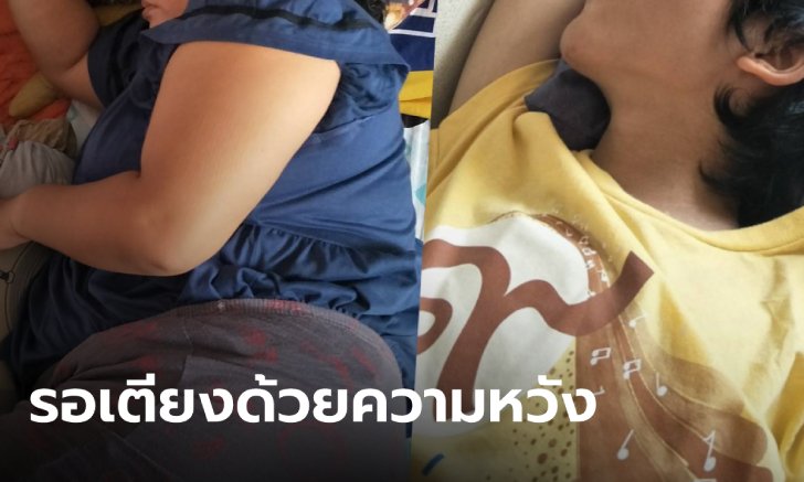 แม่ลูกติดโควิด 3 ชีวิต มีออกซิเจนถังเดียวต้องสลับกันใช้ คนในบ้านเสี่ยงสูงอีก 2 ราย
