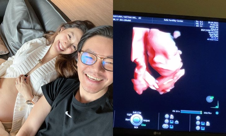ว่าที่คุณแม่สวยมาก "มิว นิษฐา" โชว์ภาพโฉมหน้าลูกสาวแบบชัดๆ อีก 2 เดือนได้เจอกันแล้ว